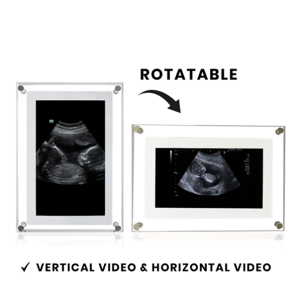 ForeverMomentsFrame™ | Digital Frame