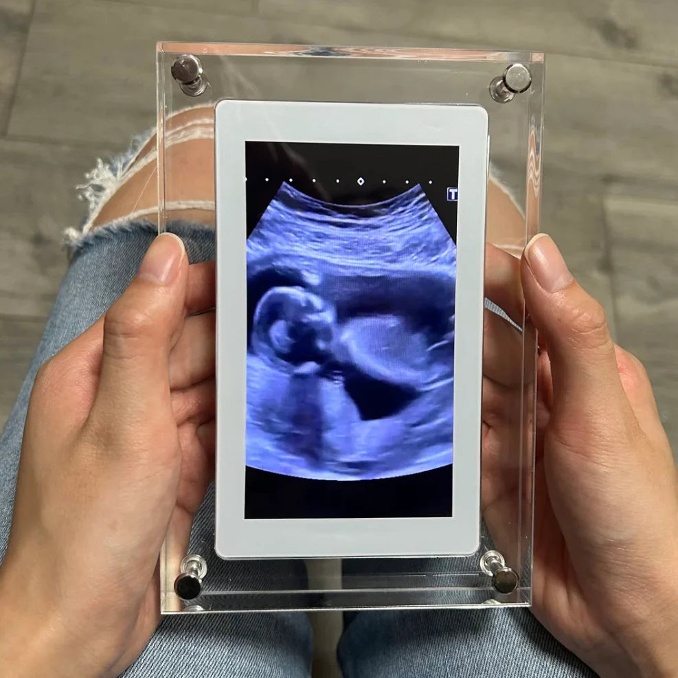 ForeverMomentsFrame™ | Digital Frame